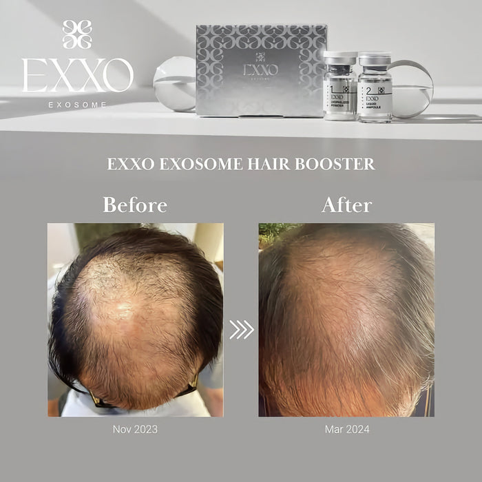 BLESKIN EXXO Exosome Hair Booster (5 treatments)