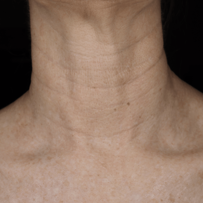 Bio - Renew EGF Neck Cream - Glo Skin Beauty UK&I