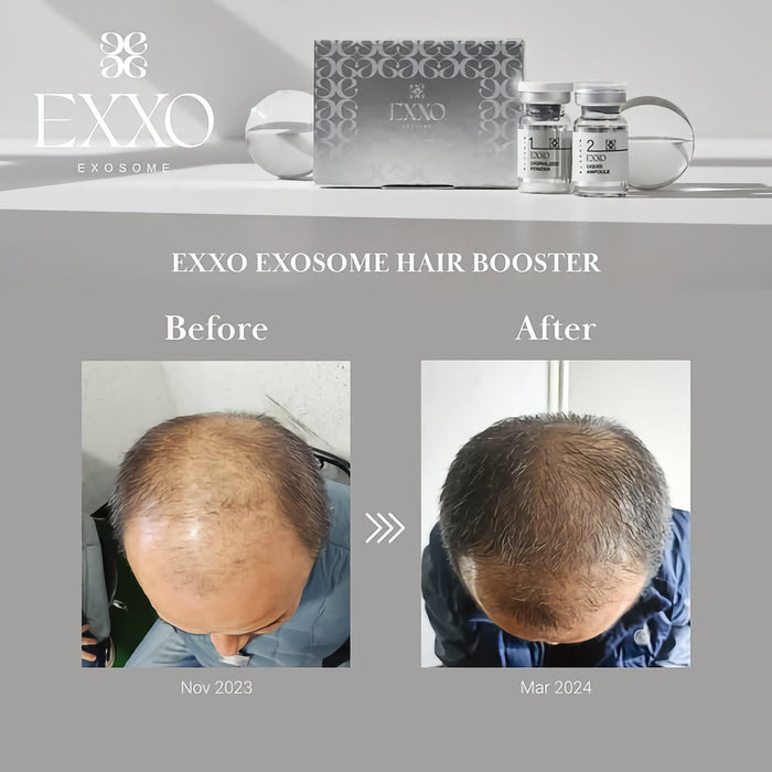 BLESKIN EXXO Exosome Hair Booster (5 treatments) - Glo Skin Beauty UK&I