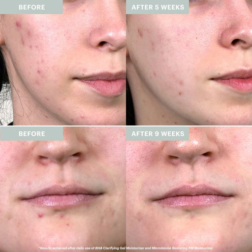 Clear Skin Hydration Duo - Travel Size - Glo Skin Beauty UK&I